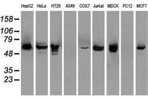 Western blot analysis of extracts (35 µg) from 9 different cell lines by using anti-CHEK2 monoclonal antibody. (CHEK2 Antikörper)