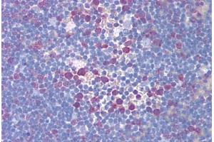 Human Thymus (formalin-fixed, paraffin-embedded) stained with TYMS antibody ABIN293172 at 5 ug/ml followed by biotinylated secondary antibody, alkaline phosphatase-streptavidin and chromogen. (TYMS Antikörper)