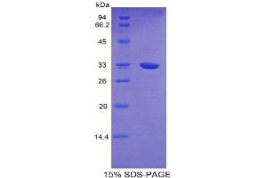 SDS-PAGE (SDS) image for Slow Skeletal Troponin T (TNNT1) (AA 1-261) protein (His tag) (ABIN2122268) (TNNT1 Protein (AA 1-261) (His tag))