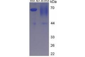 Image no. 1 for Amyloid beta 1-40 (Abeta 1-40) peptide (BSA) (ABIN5665937)
