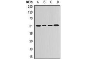 Western blot analysis of GDA expression in Hela (A), SKOV3 (B), mouse lung (C), rat brain (D) whole cell lysates. (GDA Antikörper)
