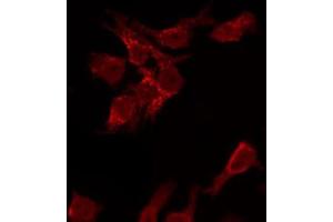 ABIN6267474 staining HeLa by IF/ICC. (AKT1 Antikörper  (pSer473))