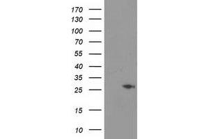 Western Blotting (WB) image for anti-Cyclin-Dependent Kinase Inhibitor 3 (CDKN3) antibody (ABIN1497462) (CDKN3 Antikörper)