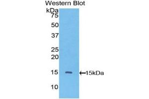 Western blot analysis of the recombinant protein. (VEGFC Antikörper  (AA 108-223))