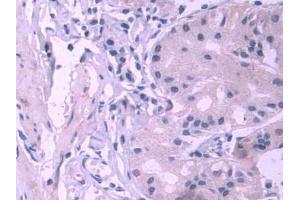DAB staining on IHC-P; Samples: Human Stomach Tissue (PES1 Antikörper  (AA 1-415))