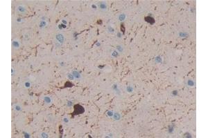 Detection of CR in Human Brain Tissue using Polyclonal Antibody to Calretinin (CR) (Calretinin Antikörper  (AA 28-248))