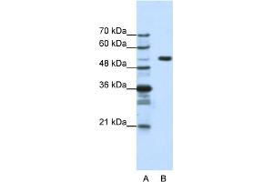 WB Suggested Anti-HCFC1 Antibody Titration:  1. (HCFC1 Antikörper  (N-Term))