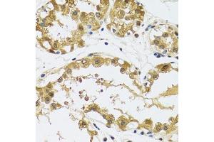 Immunohistochemistry (Paraffin-embedded Sections) (IHC (p)) image for anti-Ribosomal Protein S12 (RPS12) (AA 1-132) antibody (ABIN6147195)