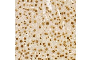 Immunohistochemistry (IHC) image for anti-Histone H4 (acLys8) antibody (ABIN7267747)