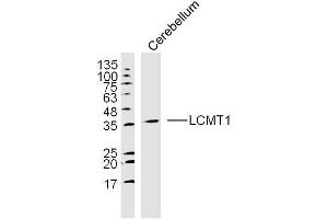 Mouse cerebellum lysates probed with LCMT1 Polyclonal Antibody, unconjugated  at 1:300 overnight at 4°C followed by a conjugated secondary antibody at 1:10000 for 90 minutes at 37°C. (LCMT1 Antikörper  (AA 45-150))