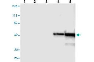 Western blot analysis of Lane 1: RT-4, Lane 2: U-251 MG, Lane 3: A-431, Lane 4: Liver, Lane 5: Tonsil with FGB polyclonal antibody . (Fibrinogen beta Chain Antikörper)
