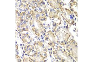Immunohistochemistry of paraffin-embedded human stomach using Lyn antibody (ABIN5998158) at dilution of 1/100 (40x lens).
