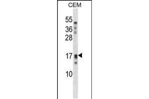 Western blot analysis in CEM cell line lysates (35ug/lane). (Kallikrein 15 Antikörper  (AA 78-106))
