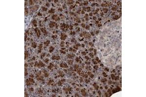 Immunohistochemical staining of human pancreas with NUDT22 polyclonal antibody  shows strong cytoplasmic positivity in exocrine glandular cells at 1:20-1:50 dilution. (NUDT22 Antikörper)