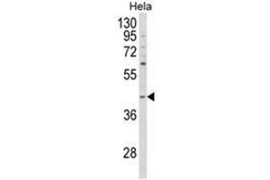 Western blot analysis of NCK1 Antibody (N-term) in Hela cell line lysates (35ug/lane). (NCK1 Antikörper  (N-Term))