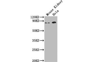 Western Blot Positive WB detected in: Mouse Kidney tissue, Hela whole cell lysate All lanes: Ripk1 antibody at 1:2000 Secondary Goat polyclonal to rabbit IgG at 1/50000 dilution Predicted band size: 75 kDa Observed band size: 75 kDa (RIPK1 Antikörper  (AA 1-656))