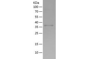 Western Blotting (WB) image for Growth Differentiation Factor 2 (GDF2) (AA 320-429) protein (His-IF2DI Tag) (ABIN7123208) (GDF2 Protein (AA 320-429) (His-IF2DI Tag))