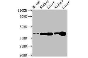 Western Blot Positive WB detected in: HL60 whole cell lysate, Rat kidney tissue, Rat liver tissue, Mouse kideny tissue, Mouse liver tissue All lanes: ADK antibody at 3 μg/mL Secondary Goat polyclonal to rabbit IgG at 1/50000 dilution Predicted band size: 41, 39, 35, 37 kDa Observed band size: 41 kDa (ADK Antikörper  (AA 18-256))