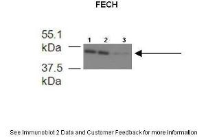 Lanes:   1. (FECH Antikörper  (Middle Region))