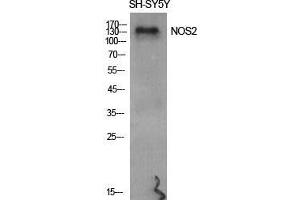 Western Blot (WB) analysis of specific cells using NOS2 Polyclonal Antibody.