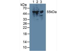 Western blot analysis of (1) Rat Liver Tissue, (2) Mouse RAW 2647 Cells and (3) Rat Brain Tissue. (TXNRD1 Antikörper  (AA 208-433))