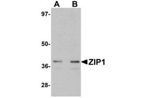 Western Blotting (WB) image for anti-Solute Carrier Family 39 (Zinc Transporter), Member 1 (SLC39A1) (N-Term) antibody (ABIN783795)