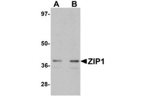 Western blot analysis of ZIP1 in mouse kidney tissue lysate with ZIP1 antibody at (A) 1 and (B) 2 μg/ml.