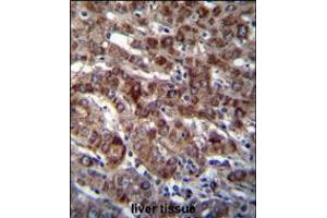DARS Antibody immunohistochemistry analysis in formalin fixed and paraffin embedded human liver tissue followed by peroxidase conjugation of the secondary antibody and DAB staining. (DARS Antikörper  (N-Term))