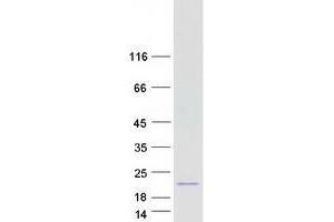 Validation with Western Blot (LHB Protein (Myc-DYKDDDDK Tag))