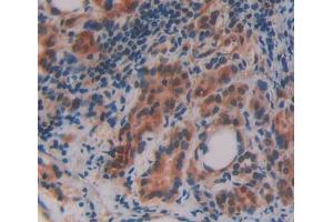 Used in DAB staining on fromalin fixed paraffin- embedded thyroid tissue (OSBP Antikörper  (AA 546-807))