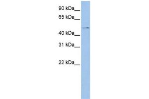 WB Suggested Anti-TSPYL4 Antibody Titration: 0.