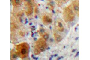 Used in DAB staining on fromalin fixed paraffin-embedded Liver tissue (PLA2G7 Antikörper  (AA 22-441))