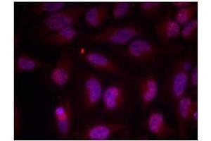 Image no. 1 for anti-Myc Proto-Oncogene protein (MYC) (pThr358) antibody (ABIN196675) (c-MYC Antikörper  (pThr358))