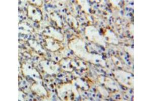 Used in DAB staining on fromalin fixed paraffin-embedded Spleen tissue (LAT Antikörper  (AA 33-227))