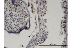 Image no. 1 for anti-LIM Homeobox Transcription Factor 1, beta (LMX1B) (AA 1-111) antibody (ABIN599395) (LMX1B Antikörper  (AA 1-111))