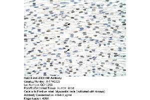 Rabbit Anti-DDX19B Antibody  Paraffin Embedded Tissue: Human Heart Cellular Data: Myocardial cells Antibody Concentration: 4. (DDX19B Antikörper  (N-Term))