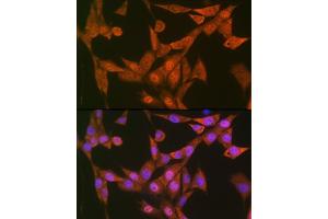 Immunofluorescence analysis of NIH-3T3 cells using LTH Rabbit mAb (ABIN7268244) at dilution of 1:100 (40x lens). (LTA4H Antikörper)