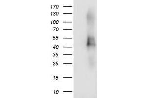 Western Blotting (WB) image for anti-Transmembrane Protein with EGF-Like and Two Follistatin-Like Domains 2 (TMEFF2) antibody (ABIN1501417) (TMEFF2 Antikörper)