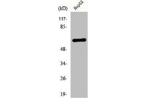 Western Blot analysis of HepG2 cells using Cytokeratin 5 Polyclonal Antibody (Cytokeratin 5 Antikörper  (C-Term))
