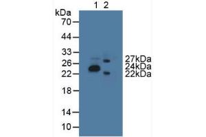 Figure. (GLTP Antikörper  (AA 2-209))