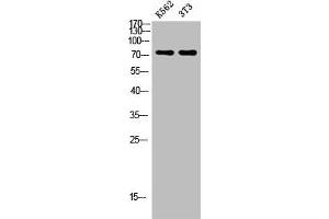 Western blot analysis of K562 3T3 lysate, antibody was diluted at 500. (Endoglin Antikörper  (AA 370-430))