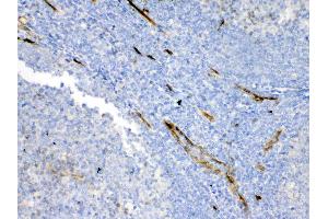 IHC analysis of Bcl-XL using anti-Bcl-XL antibody . (BCL2L1 Antikörper  (AA 1-219))