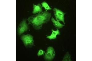 Detection of HSPA1A in A549 cells using Polyclonal Antibody to Heat Shock 70 kDa Protein 1A (HSPA1A) (HSP70 1A Antikörper  (AA 1-641))