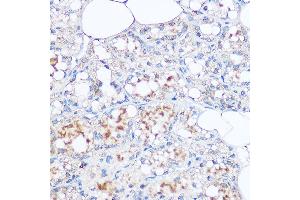 Immunohistochemistry of paraffin-embedded rat breast using MGP Rabbit pAb (ABIN6128268, ABIN6143825, ABIN6143826 and ABIN6221090) at dilution of 1:100 (40x lens). (MGP Antikörper  (AA 20-103))
