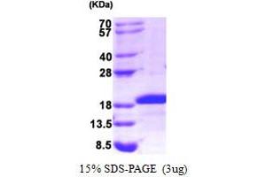SDS-PAGE (SDS) image for Midkine (Neurite Growth-Promoting Factor 2) (MDK) (AA 21-143) protein (His tag) (ABIN666781)