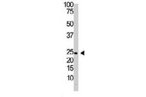 The IL29 polyclonal antibody  is used in Western blot to detect IL29 in Jurkat cell lysate. (IL29 Antikörper  (Internal Region))