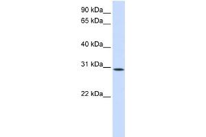 WB Suggested Anti-KIAA0247 Antibody Titration:  0. (SUSD6/KIAA0247 Antikörper  (N-Term))