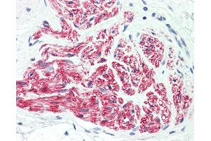 Anti-L1CAM antibody IHC staining of human peripheral nerve. (L1CAM Antikörper  (AA 1154-1182))