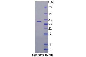 SDS-PAGE (SDS) image for CCAAT/enhancer Binding Protein (C/EBP), delta (CEBPD) (AA 51-251) protein (His tag) (ABIN4989272)