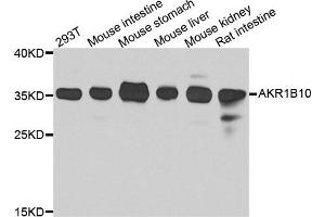 Western blot analysis of extracts of various cell lines, using AKR1B10 antibody. (AKR1B10 Antikörper)